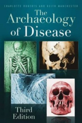 Книга Archaeology of Disease Charlotte Roberts