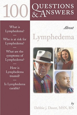 Kniha 100 Questions  &  Answers About Lymphedema Debbie Daunt