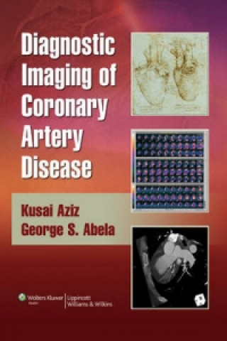 Kniha Diagnostic Imaging of Coronary Artery Disease Kusai Aziz