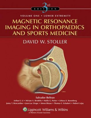 Carte Magnetic Resonance Imaging in Orthopaedics and Sports Medicine David W Stoller