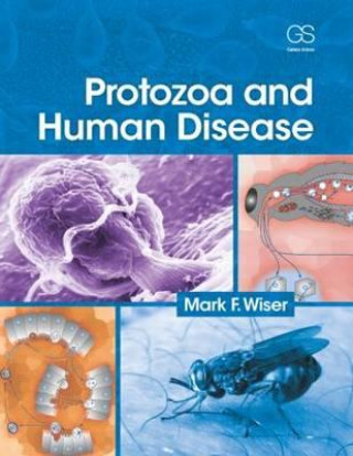 Kniha Protozoa and Human Disease Mark F Wiser