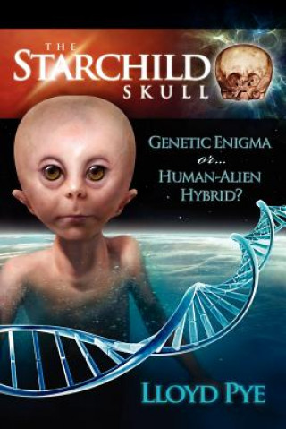 Carte Starchild Skull -- Genetic Enigma or Human-Alien Hybrid? Lloyd Pye