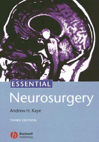 Kniha Essential Neurosurgery Andrew Kaye