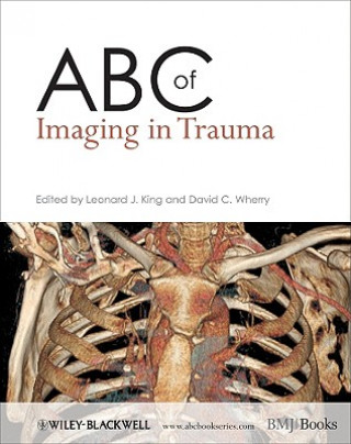 Carte ABC of Imaging in Trauma King