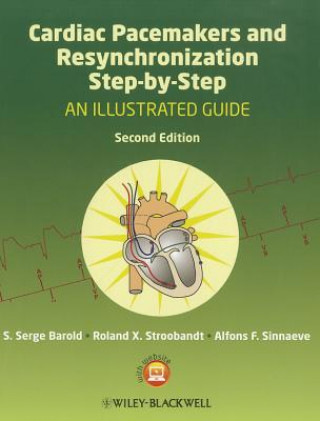 Книга Cardiac Pacemakers and Resynchronization Step by Step - An Illustrated Guide 2e S Serge Barold