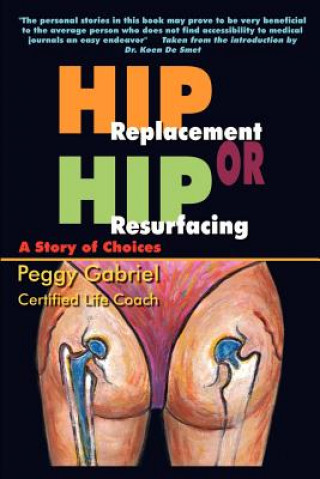 Könyv Hip Replacement or Hip Resurfacing: A Story of Choices Peggy Gabriel