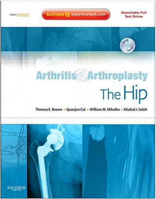 Kniha Arthritis and Arthroplasty: The Hip Thomas Brown