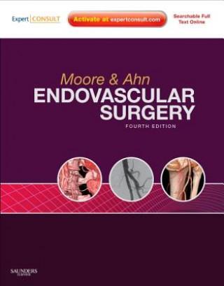 Könyv Endovascular Surgery Wesley S. Moore