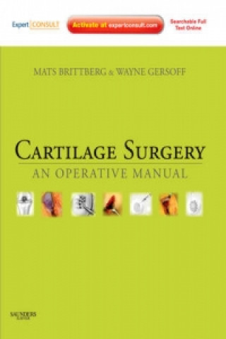 Boek Cartilage Surgery Mats Brittberg