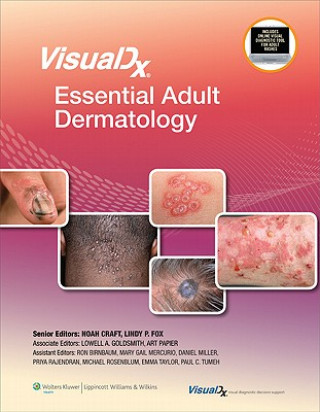 Carte VisualDx: Essential Adult Dermatology Noah Craft