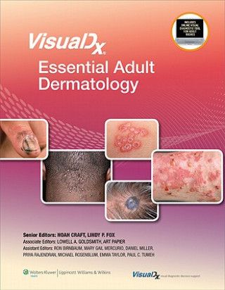 Kniha VisualDx: Essential Adult Dermatology Noah Craft