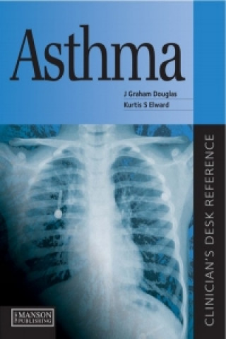 Kniha Asthma J. Graham Douglas