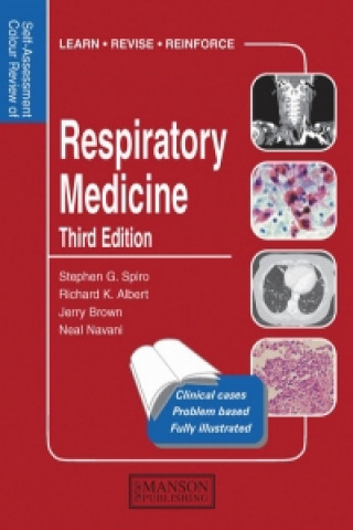 Könyv Respiratory Medicine Stephen G Spiro