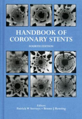 Carte Handbook of Coronary Stents P W Serruys