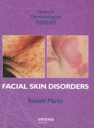 Kniha Facial Skin Disorders Ronald Marks