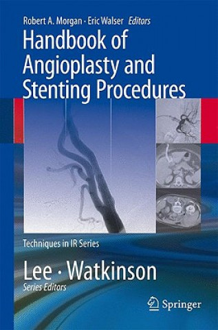 Carte Handbook of Angioplasty and Stenting Procedures Robert Morgan