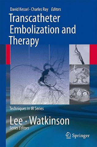 Kniha Transcatheter Embolization and Therapy David Kessel