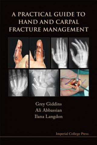 Könyv Practical Guide To Hand And Carpal Fracture Management, A Grey Giddins