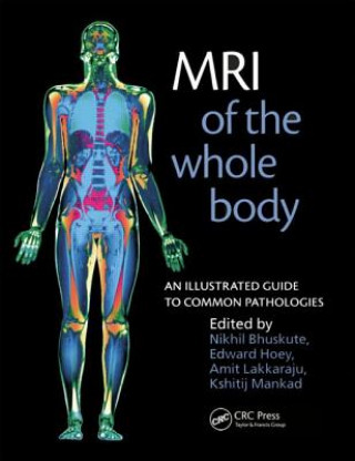 Kniha MRI of the Whole Body Nikhil Bhuskute