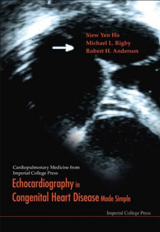 Книга Echocardiography In Congenital Heart Disease Made Simple Siew Yen Ho