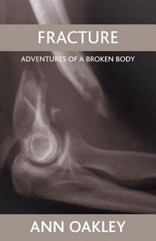 Книга Fracture Ann Oakley
