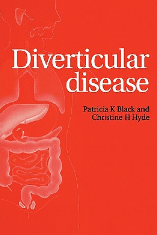 Kniha Diverticular Disease Patricia K. Black