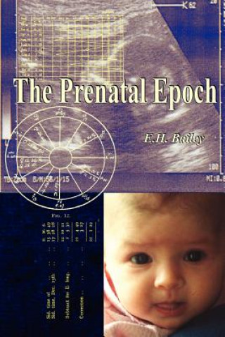 Kniha Prenatal Epoch E.