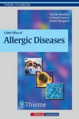 Книга Color Atlas of Allergic Diseases Martin Roecken