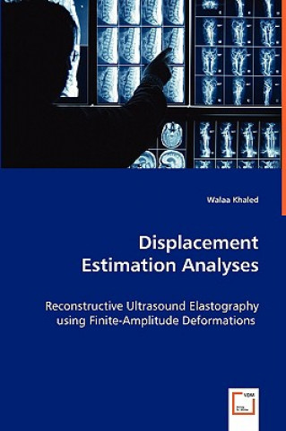 Carte Displacement Estimation Analyses Walaa Khaled