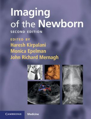 Książka Imaging of the Newborn Haresh Kirpalani