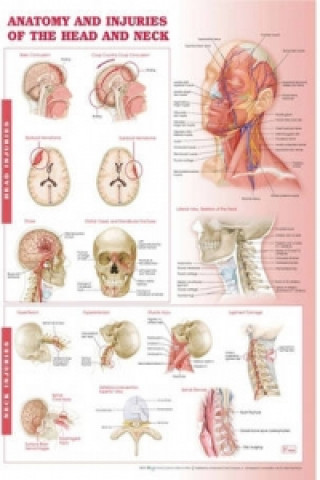 Carte Anatomy and Injuries of the Head and Neck Anatomical Chart 