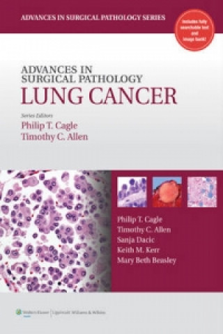 Książka Advances in Surgical Pathology: Lung Cancer Philip Cagle