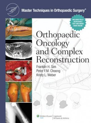 Könyv Master Techniques in Orthopaedic Surgery: Orthopaedic Oncology and Complex Reconstruction Frankln Sim