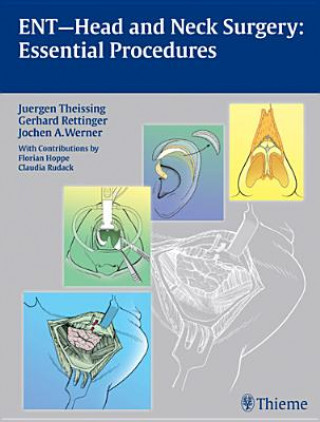 Könyv ENT Head and Neck Surgery: Essential Procedures Jürgen Theissing