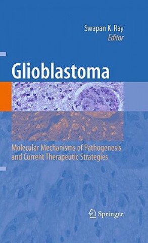 Kniha Glioblastoma: Swapan K Ray