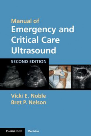 Книга Manual of Emergency and Critical Care Ultrasound Vicki Noble