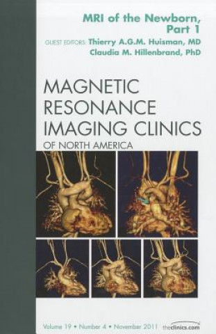Kniha MRI of the Newborn, Part I, An Issue of Magnetic Resonance Imaging Clinics Claudia Hillenbrand