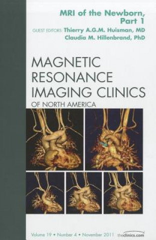 Książka MRI of the Newborn, Part I, An Issue of Magnetic Resonance Imaging Clinics Claudia Hillenbrand