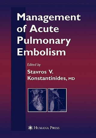 Knjiga Management of Acute Pulmonary Embolism Stavros Konstantinides