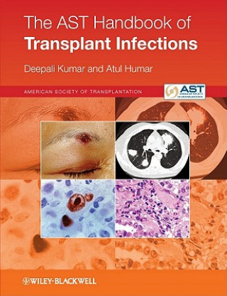 Könyv AST Handbook of Transplant Infections Deepali Kumar