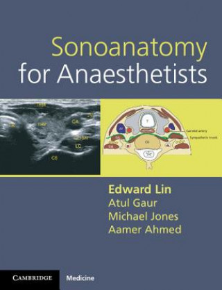 Kniha Sonoanatomy for Anaesthetists Edward Lin