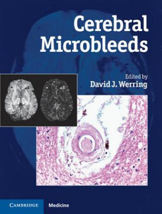 Carte Cerebral Microbleeds David Werring