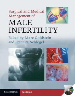 Книга Surgical and Medical Management of Male Infertility Marc Goldstein