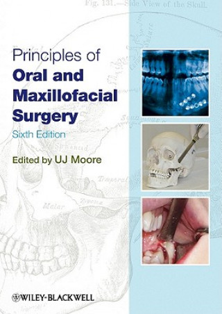 Книга Principles of Oral and Maxillofacial Surgery 6e U. J. Moore