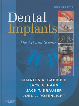 Książka Dental Implants Charles A Babbush