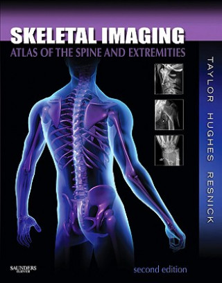 Kniha Skeletal Imaging John A M Taylor