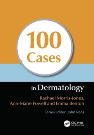 Könyv 100 Cases in Dermatology Rachael Morris-Jones