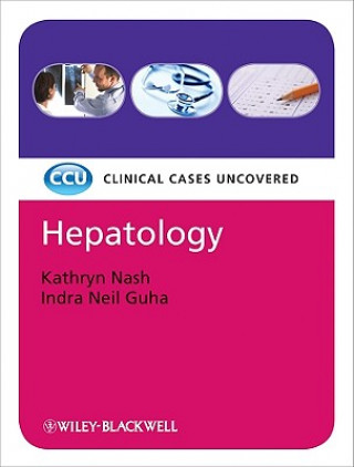 Kniha Hepatology - Clinical Cases Uncovered Kathryn Nash