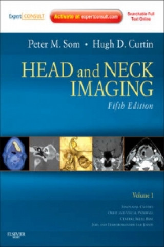 Könyv Head and Neck Imaging - 2 Volume Set Peter Som