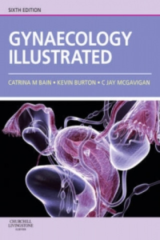 Kniha Gynaecology Illustrated Catrina Bain
